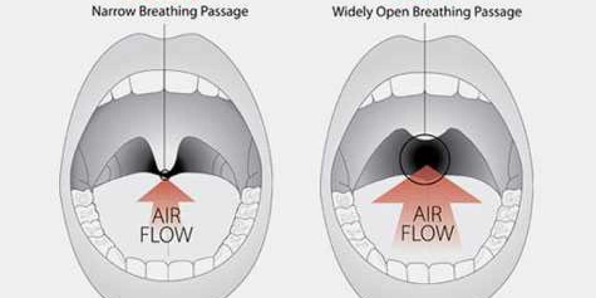 Understanding Snoring: Causes and When to Seek Help from an ENT Specialist