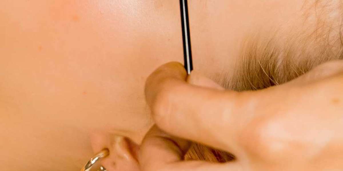 Ultimate Guide to Lash Lift: Everything You Need to Know