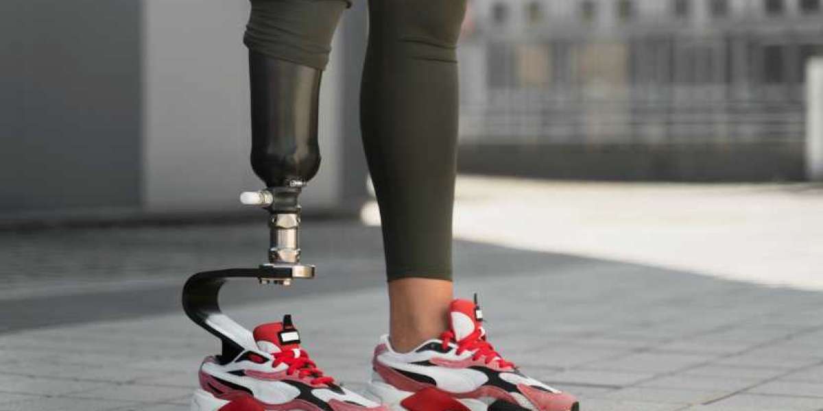 Femoral Head Prostheses Market Growth & Trends 2034