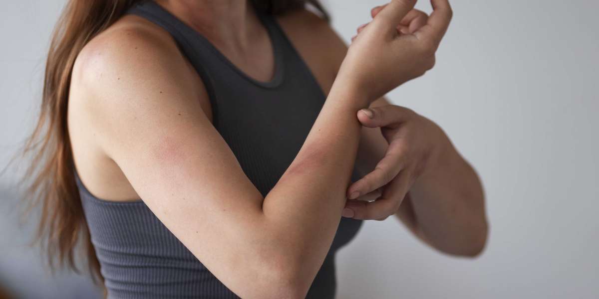 How Plastic Surgery Can Repair Your Burn Scars