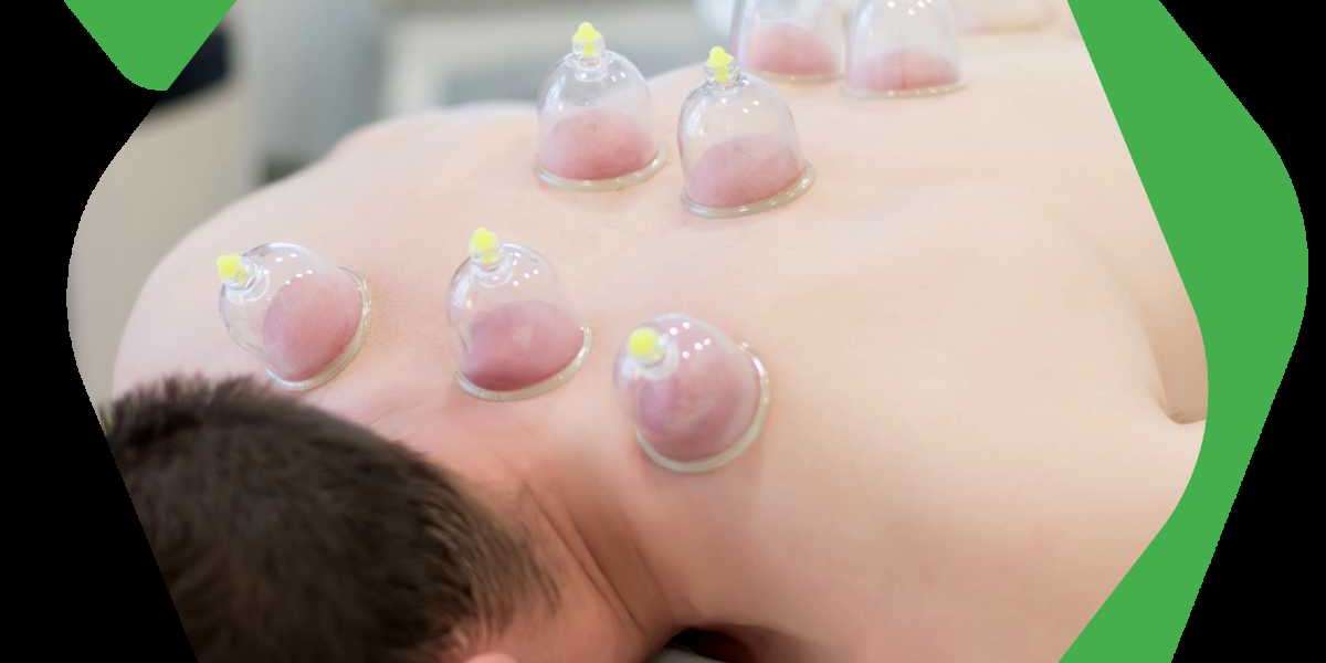 Chinese Acupuncture in Calgary – Sincere Clinic