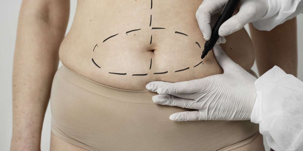 Six Things You Need To Know About Thigh Liposuction