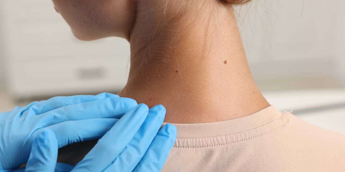 Why whiplash pain sometimes appears days after an accident