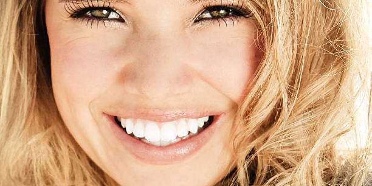 Hollywood Smile in Islamabad: Achieve a Bright, Balanced and Perfect Smile